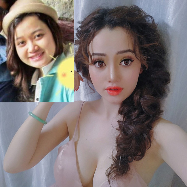 Cô gái Sài Gòn sinh năm 1995 Trương Ngọc Trân quyết định thẩm mỹ vì "dậy thì thất bại", có thân hình béo tròn, mũi to, mặt ngấn mỡ.