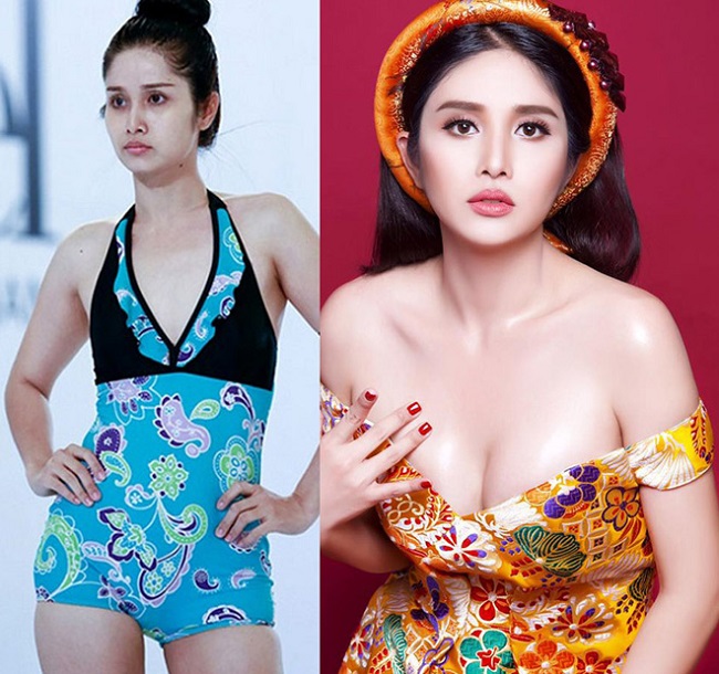 Sau ly hôn cầu thủ Phan Thanh Bình năm 2015, cựu người mẫu Thảo Trang quyết định phẫu thuật thẩm mỹ để xinh đẹp, quyến rũ hơn. Cụ thể là cô nâng ngực và sửa mũi. 