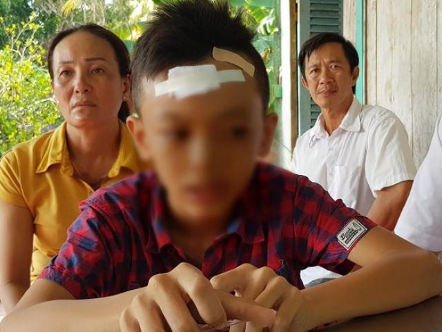 Giáo dục - du học - Nam sinh lớp 7 bị bạn đánh chảy máu đầu, ngất xỉu