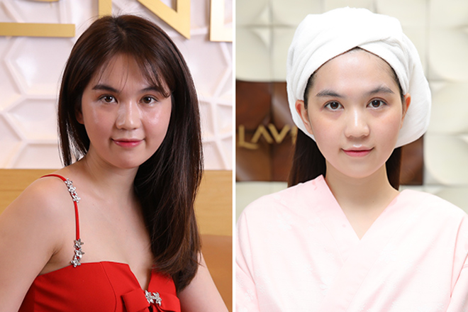 Loạt sao Việt nói gì về viện thẩm mỹ vừa nhận giải Top 1 trẻ hóa da châu Á - 4