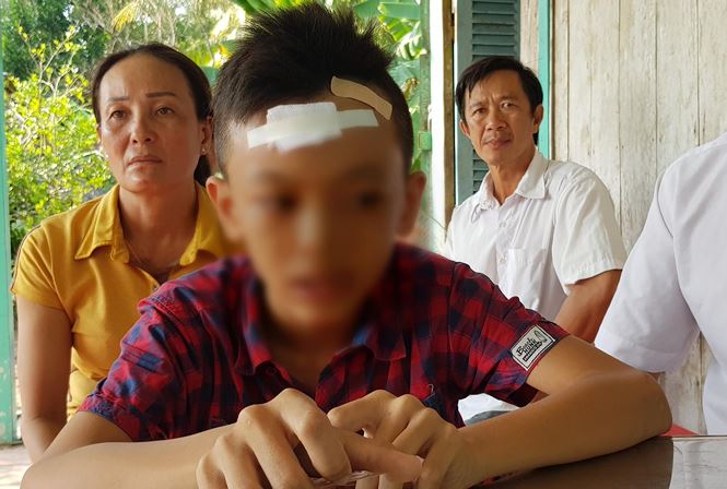 Nam sinh lớp 7 bị bạn đánh chảy máu đầu, ngất xỉu - 1