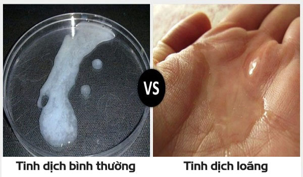 Người bị tinh trùng loãng nên ăn gì? Nhóm thực phẩm nào tốt cho nam giới? - 1