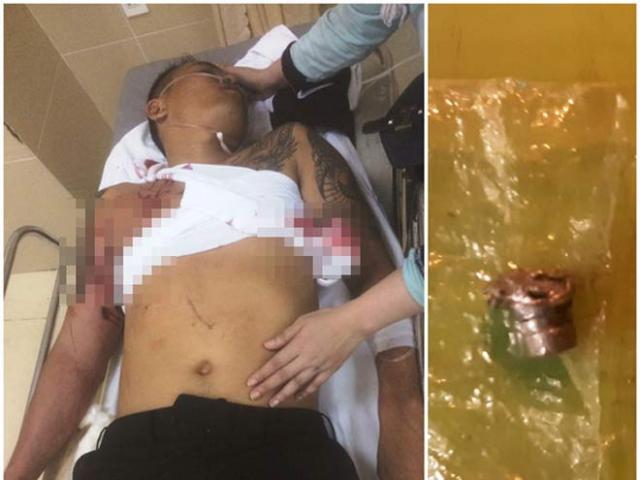 Pháp luật - Một thanh niên bị bắn khi đang uống cà phê