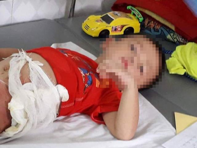 Pháp luật - Tạm giữ bác ruột ném cháu trai 4 tuổi vào đống lửa