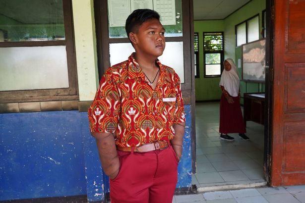 Bộ dạng mới gây sốc của cậu bé từng nặng gần 2 tạ, béo nhất thế giới - 2