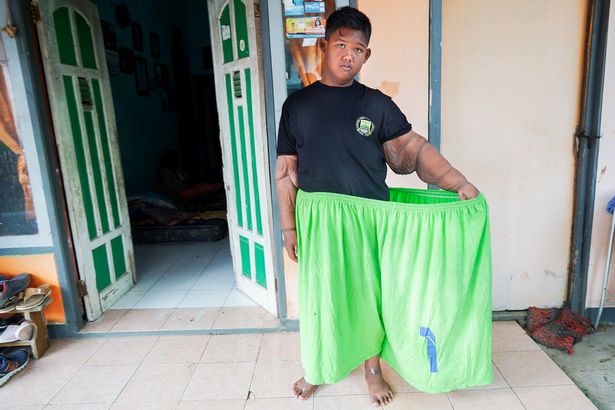 Bộ dạng mới gây sốc của cậu bé từng nặng gần 2 tạ, béo nhất thế giới - 4