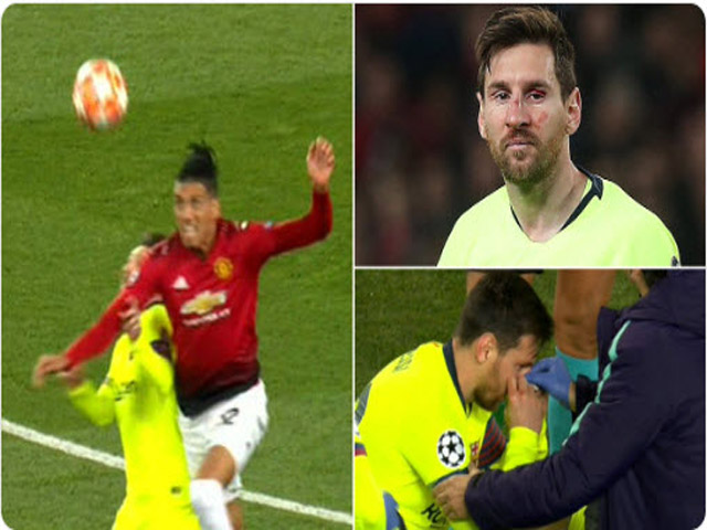 Messi đổ máu ở đại chiến MU - Barcelona cúp C1: Smalling không nói đùa