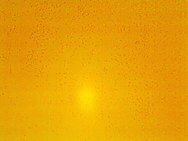 Bảo vệ đại tràng nhờ bào tử lợi khuẩn LiveSpo Colon - 2