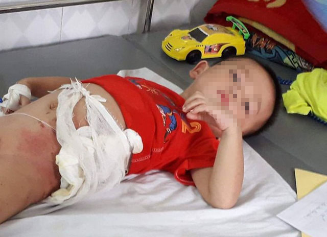 Thân thế bất hảo của đối tượng ném cháu ruột vào đống lửa - 1