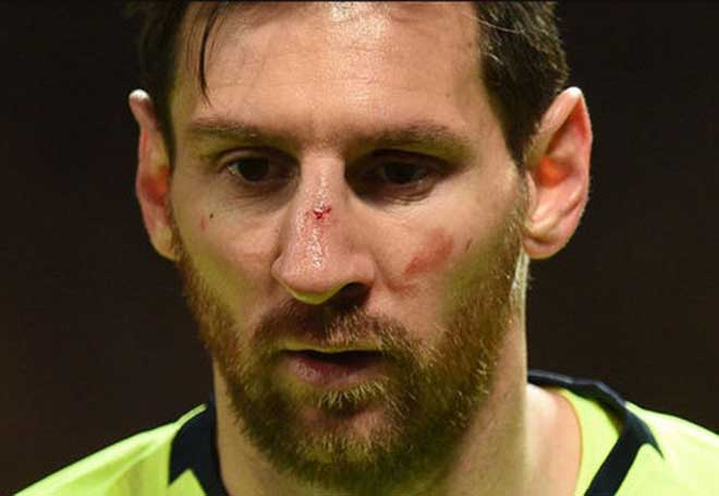 Chi tiết Huesca - Barcelona: Kết thúc nhạt hòa (KT) - 5