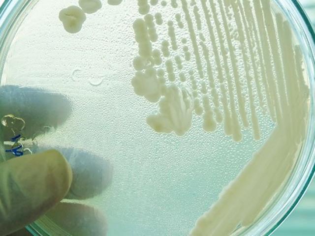 Sức khỏe đời sống - Siêu nấm “giết người” đang lan rộng khắp thế giới