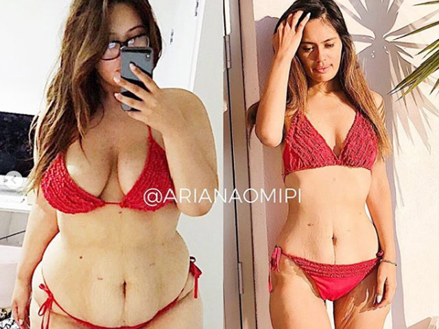 Làm đẹp - Cuộc "lột xác" hoàn hảo của hot girl béo 1,3 tạ sau khi cắt dạ dày