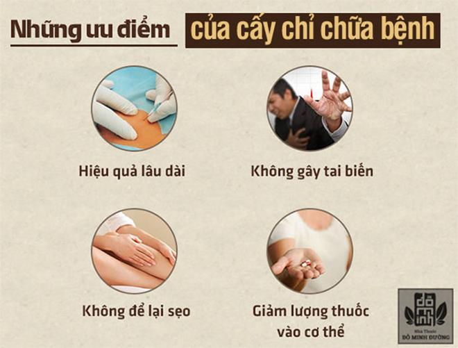 Cấy chỉ chữa viêm xoang: Cách chữa bệnh không dùng thuốc giúp giảm hẳn ngạt, tắc mũi - 2