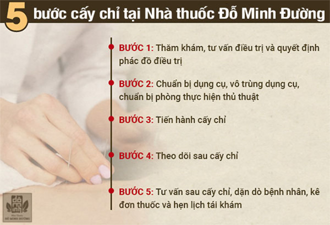 Cấy chỉ chữa viêm xoang: Cách chữa bệnh không dùng thuốc giúp giảm hẳn ngạt, tắc mũi - 4