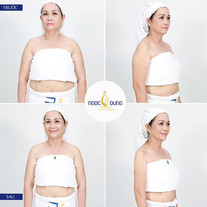 Chị em cập nhật ngay xu hướng giảm béo an toàn “lên ngôi” năm 2019 - 4