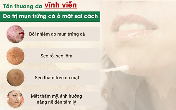Mụn trứng cá ở mặt: Chuyên gia chỉ cách đánh bay mụn hiệu quả - 1