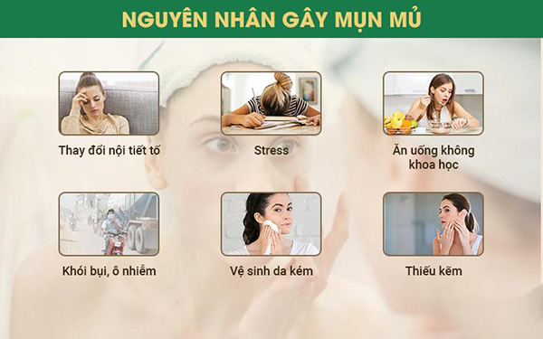 Cách hỗ trợ điều trị mụn mủ hiệu quả theo chỉ dẫn của chuyên gia - 1