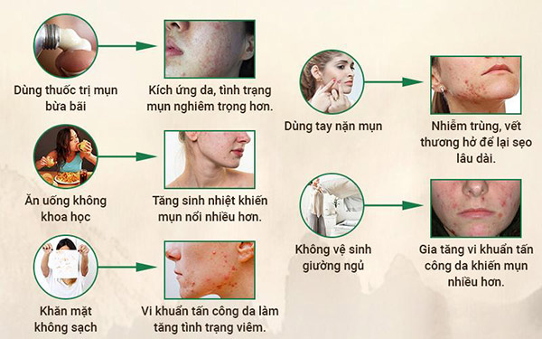 Mụn viêm, sưng: Hỗ trợ điều trị hiệu quả bằng phương pháp Đông y không gây biến chứng - 1