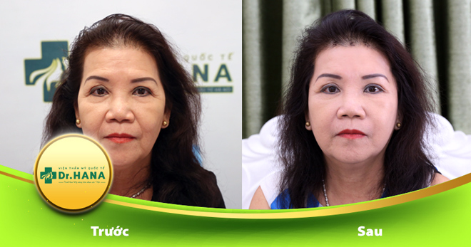 Thật đáng tiếc nếu đến giờ bạn vẫn chưa biết bí quyết trẻ hóa da này! - 2