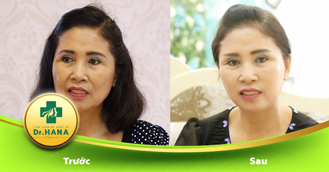 Thật đáng tiếc nếu đến giờ bạn vẫn chưa biết bí quyết trẻ hóa da này! - 3