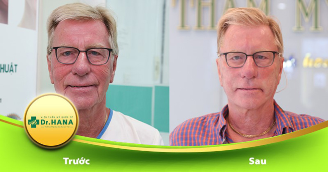 Thật đáng tiếc nếu đến giờ bạn vẫn chưa biết bí quyết trẻ hóa da này! - 5