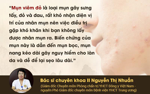 Cách cải thiện mụn viêm đỏ tận gốc trả lại làn da mịn màng không tì vết - 1