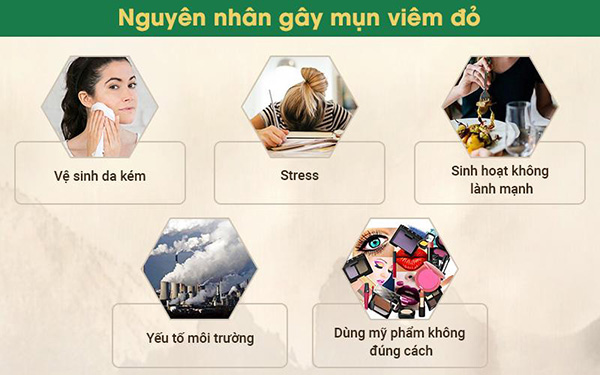 Cách cải thiện mụn viêm đỏ tận gốc trả lại làn da mịn màng không tì vết - 2