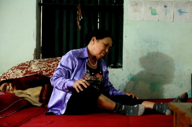 Mất ăn, mất ngủ, ngón tay cứng đờ vì viêm đa khớp - 2