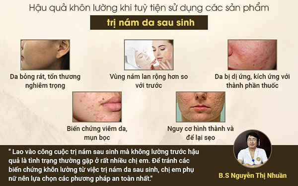 Trị nám da sau sinh không còn nan giải với thảo dược thiên nhiên lành tính - 1