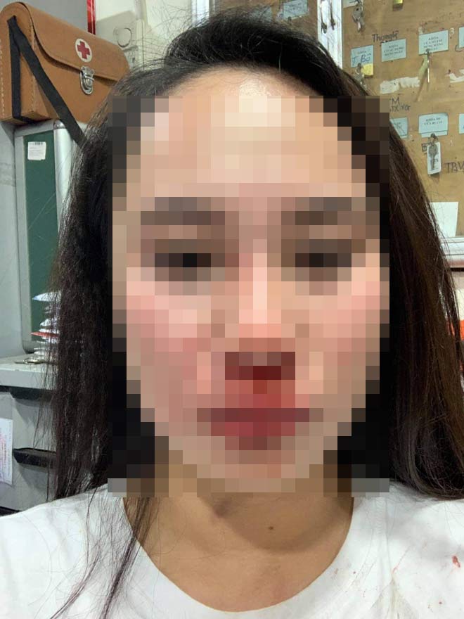 Những cơn thịnh nộ ghê người khi đàn bà nổi cơn ghen - 1