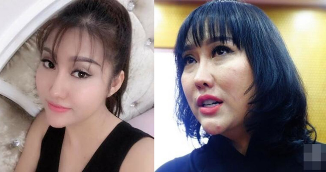 Năm 2018, Phi Thanh Vân để lộ gương mặt sần sùi không như ảnh đăng tải trên trang cá nhân. Nhiều người cho rằng đây là một hậu quả của việc thẩm mỹ. 
