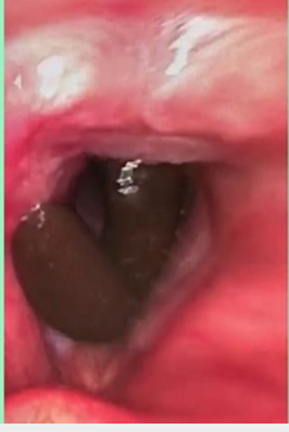 Hoảng hồn vì những con đỉa trốn kỹ trong cơ thể người tới mức bác sĩ khó tìm - 1