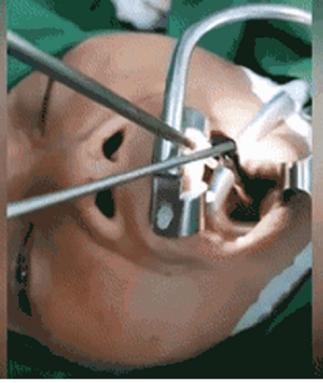 Hoảng hồn vì những con đỉa trốn kỹ trong cơ thể người tới mức bác sĩ khó tìm - 2