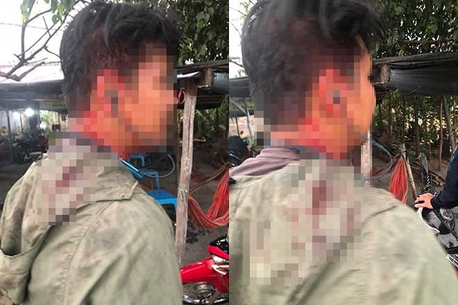 Nóng 24h qua: “Chặt chém” rồi đánh khách chảy máu đầu, quán ăn bị đập phá - 2