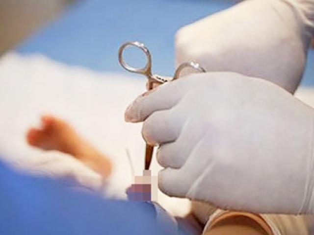 Sức khỏe đời sống - Thanh niên 28 tuổi bị cắt 1/5 “của quý” sau khi cố tự điều trị