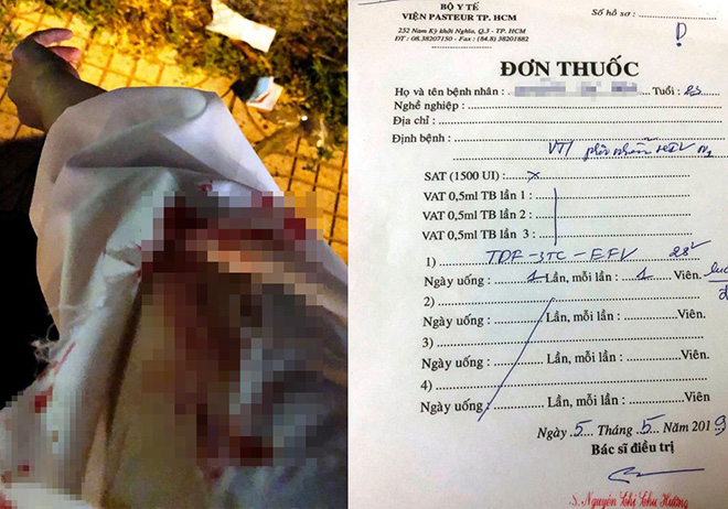 Bị người lạ đâm chảy máu khi dừng đèn đỏ, cô gái phải điều trị phơi nhiễm HIV - 1