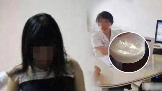 Cô gái 22 tuổi chưa chồng, chưa bạn trai, phát hiện ngực tiết sữa do uống thuốc giảm cân - 1