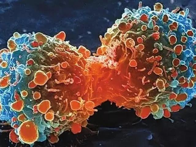 Sức khỏe đời sống - Thủ phạm rất quen thuộc khiến mỗi ngày có thêm 66 người Việt nhận án tử