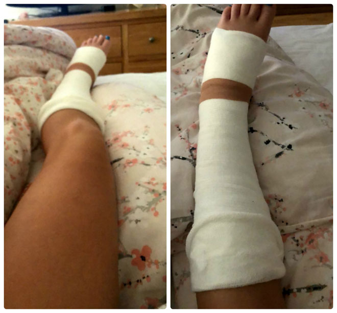 Cả thế giới phải nể: Mỹ nữ gãy chân vẫn chạy 29km về đích - 4