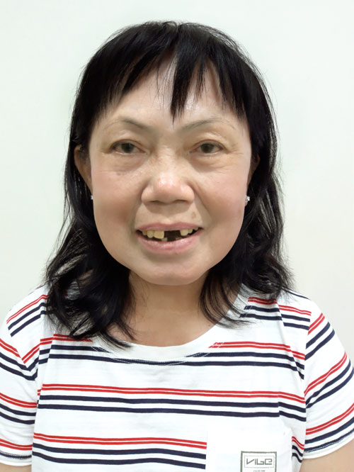 Quý bà U70 sở hữu hàm răng vàng khiến dân tình ngã ngửa - 1