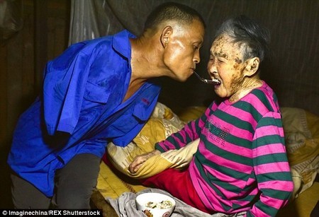 Con không tay dùng miệng bón thức ăn cho mẹ 91 tuổi gây xúc động - 1