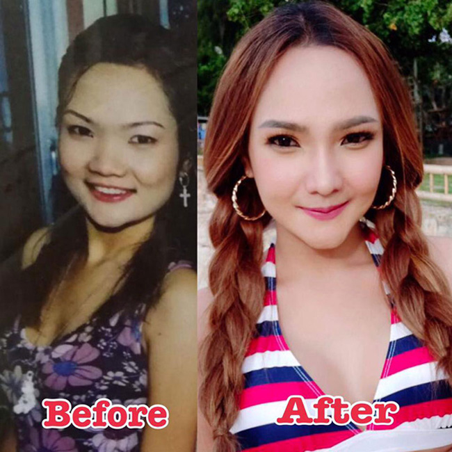 Chẳng bao lâu, người chồng mà cô yêu đã nộp đơn ly hôn để đến sống với bạn gái mới vì cho rằng vợ quá xấu khiến anh ta không còn chút tình cảm nào. Vì quá đau đớn, Linda đã quyết tâm phải thay đổi ngoại hình để khiến chồng hối hận. Cô rút tiền tiết kiệm, chi 1,5 triệu baht &#40;Tương đương hơn 1 tỷ đồng&#41; để tân trang lại khuôn mặt, bơm ngực… Sau đó cô dành thời gian để tập thể dục giảm cân.
