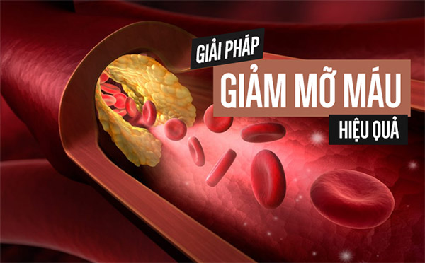 Nattokinase Jintan - bí quyết làm giảm cholesterol trong máu từ Nhật Bản - 3