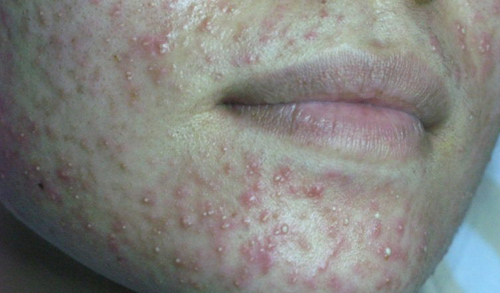 Kami Skin – Bí quyết cho làn da sạch nám, sáng khỏe - 2