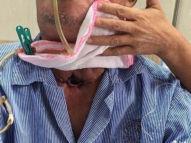 Sức khỏe đời sống - Điểm danh 8 “siêu hóa chất” trong thuốc lá đốt thanh quản của bạn