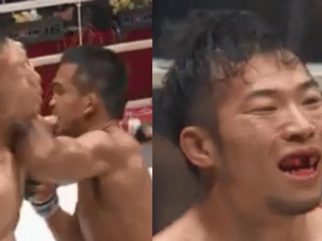 Thể thao - Choáng váng MMA: Bị cùi chỏ gãy 2 răng vẫn "ngược dòng" không tưởng