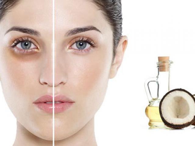 Làm đẹp - 5 lời khuyên trên mạng tưởng tốt nhưng gây hỏng da khó cứu chữa