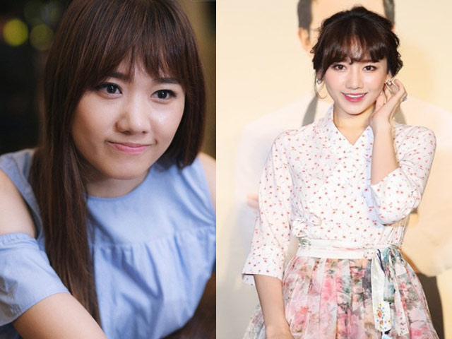 Làm đẹp - Hari Won bị nghi "theo chân" Trấn Thành sửa mũi