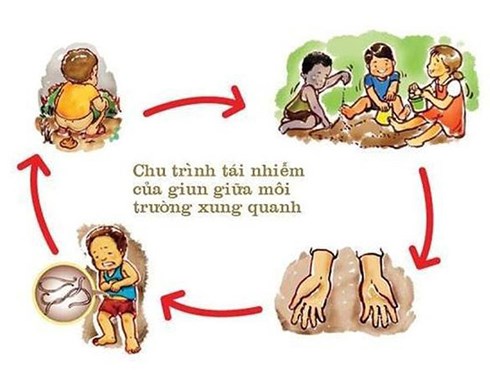 Tưởng bị táo bón, bác sĩ gắp ra từ ruột bé trai 4 tuổi cả chậu giun - 2