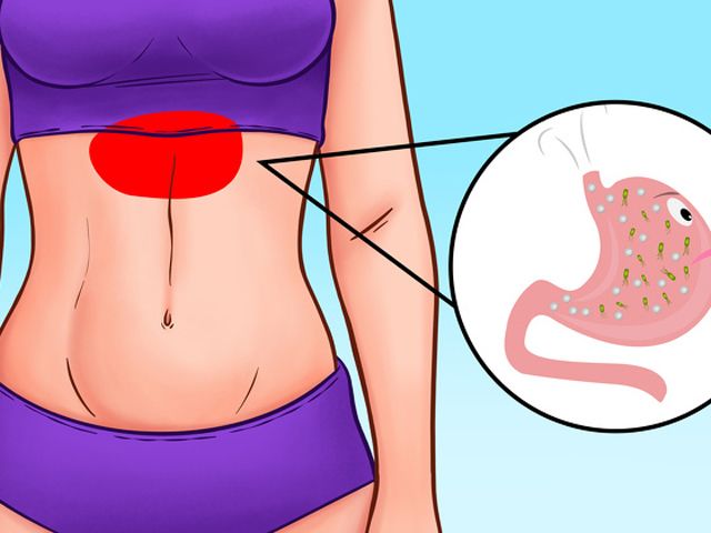 Sức khỏe đời sống - Bắt bệnh chuẩn xác thông qua 9 vị trí đau bụng thường gặp